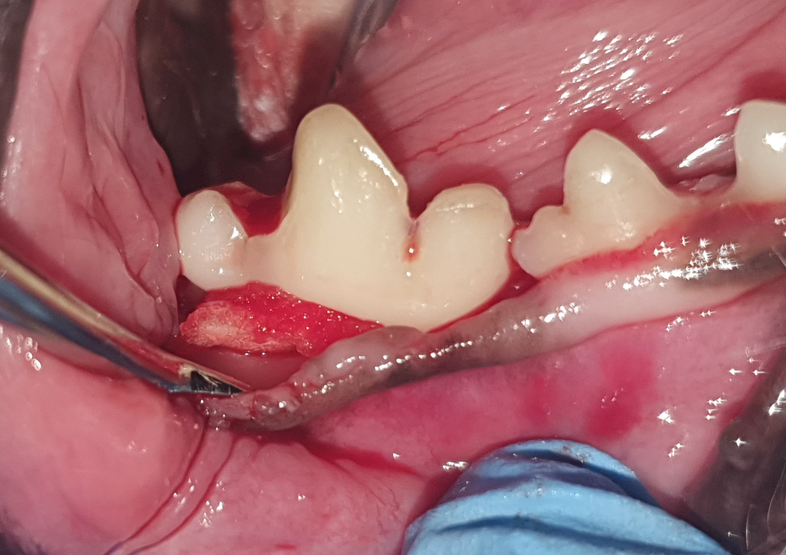 Leczenie periodontologiczne — Po