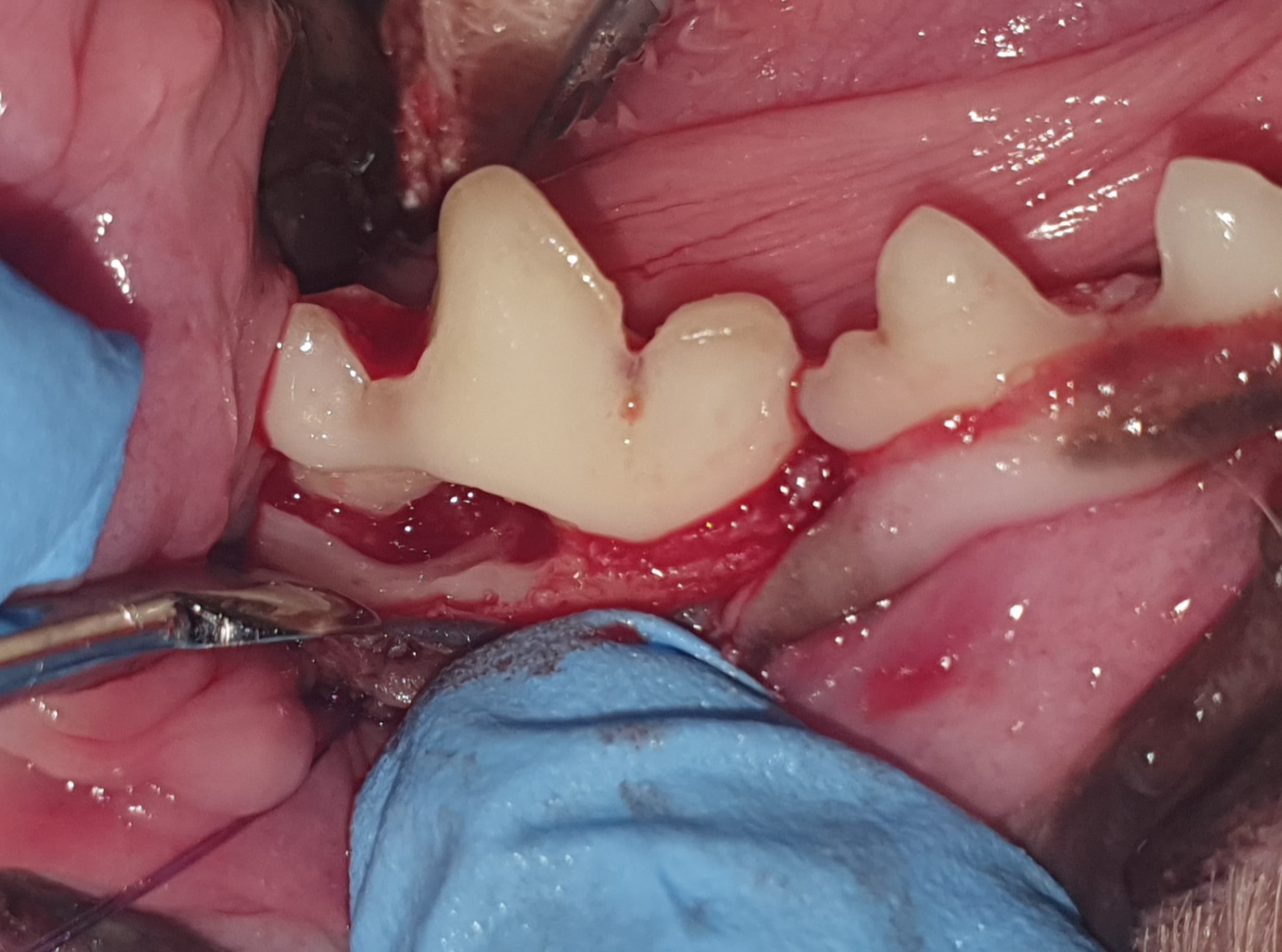 Leczenie periodontologiczne — Przed