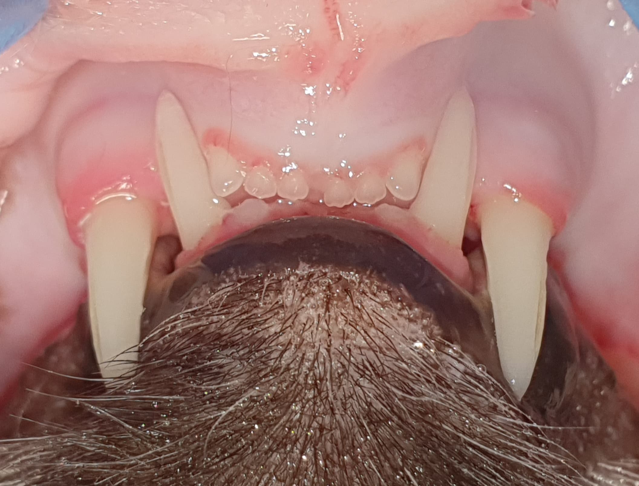 Traumatologia — separacja spojenia żuchwy — Po