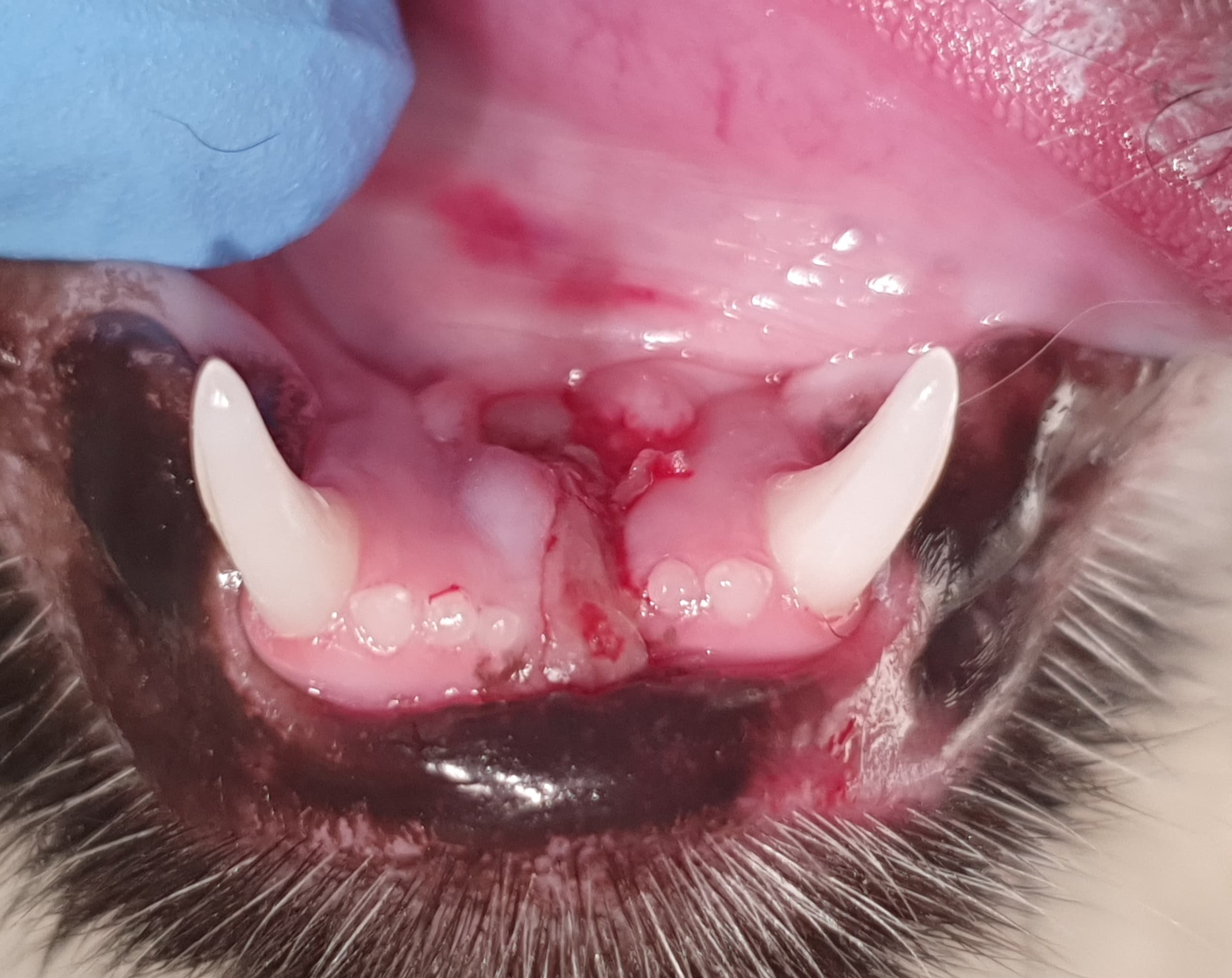 Traumatologia — separacja spojenia żuchwy — Przed