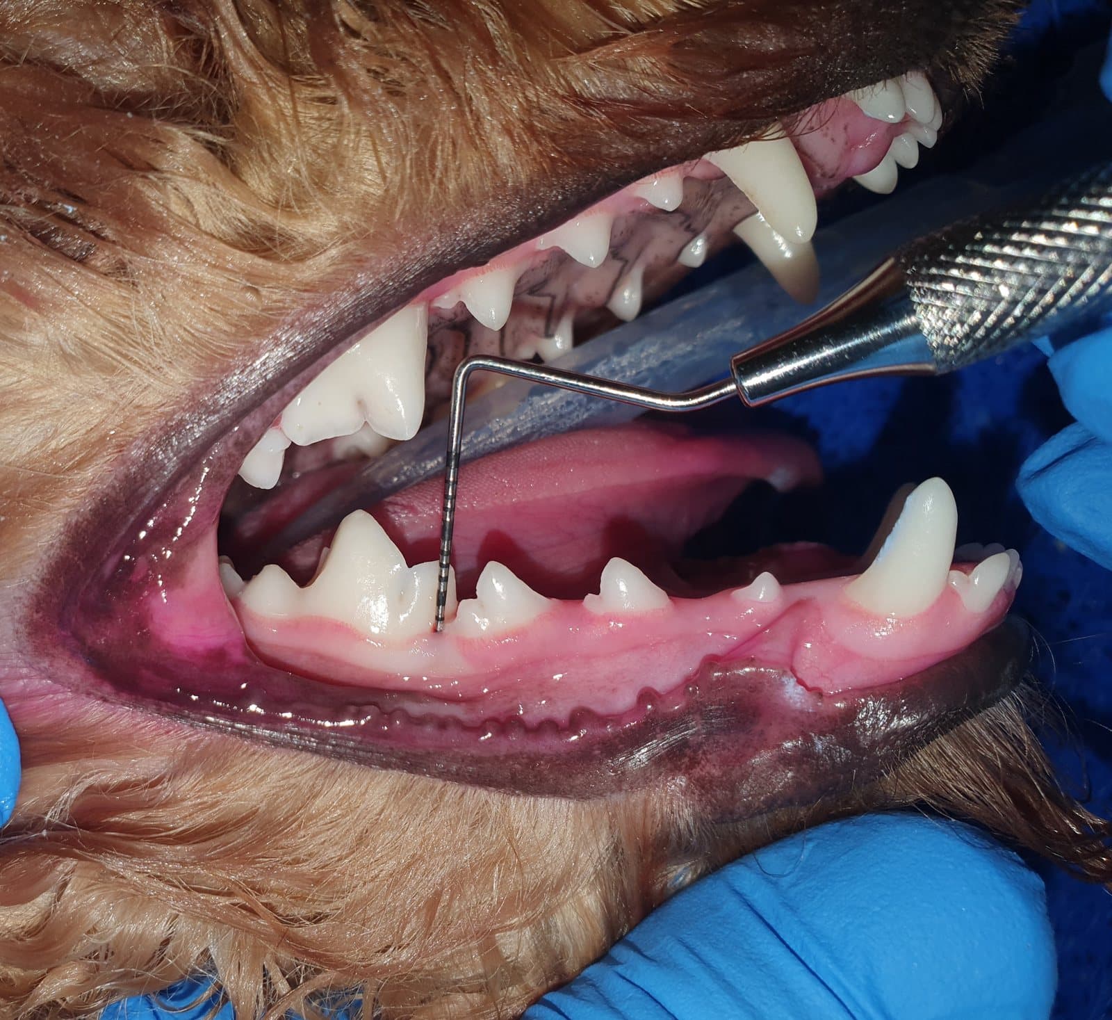 leczenie periodontologiczne — sondowanie przyzębia